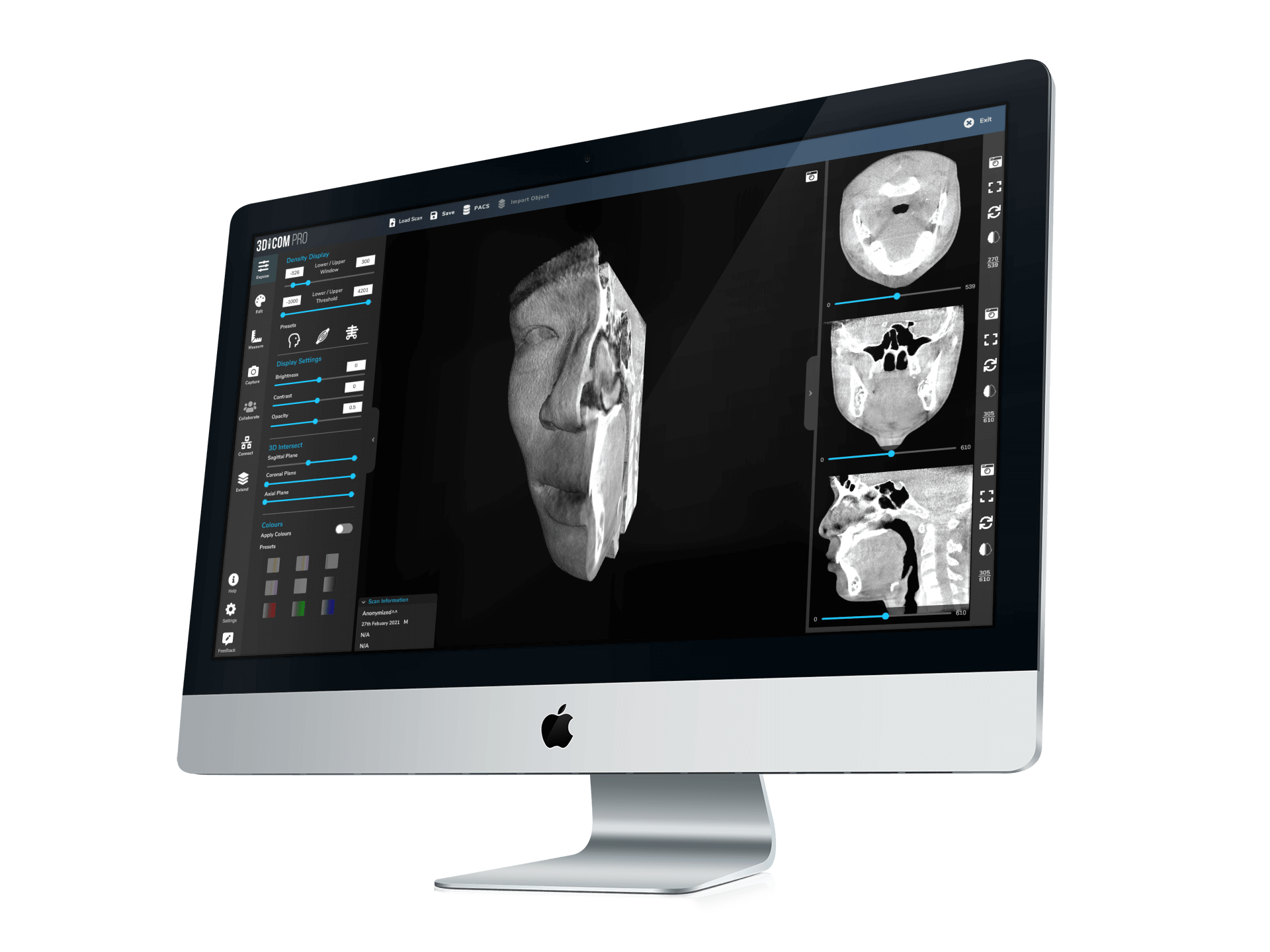 medical viewer for mac